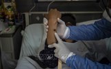 WHO: Bệnh đậu mùa khỉ vẫn là tình trạng khẩn cấp về sức khỏe cộng đồng toàn cầu 