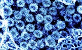 COVID-19 nặng có thể 'đánh lừa' hệ miễn dịch