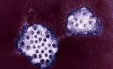 Dịch cúm dạ dày bùng phát tại Mỹ sau làn sóng COVID-19