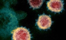 Vì sao truy tìm nguồn gốc virus SARS-CoV-2 giống như “mò kim đáy bể“?