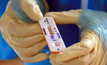 Bộ Y tế trả lời về tình trạng khan hiếm và biến động giá kit test xét nghiệm SARS-CoV-2
